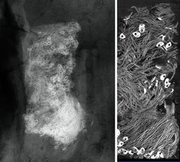 6- X-ray (left) and Micro CT imaging (right) of silver fringe found with William West.